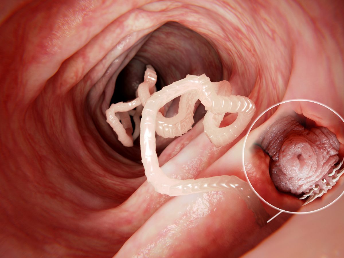 Parasitoses intestinais em Farmácia Comunitária