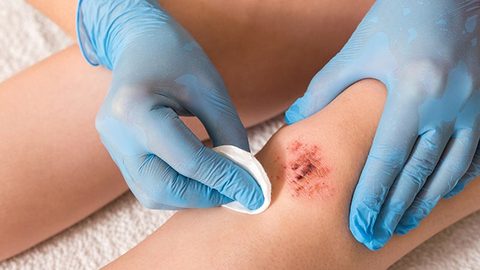 Como ajudar o doente a cuidar de feridas?